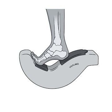 HEALMO Trainer apparatus ankle stretch